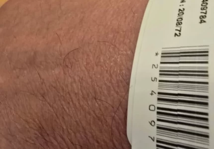 Έναρξη πιλοτικής λειτουργίας συστήματος ηλεκτρονικής ιχνηλάτησης των ασθενών στο ΤΕΠ του νοσοκομείου «Ευαγγελισμός»