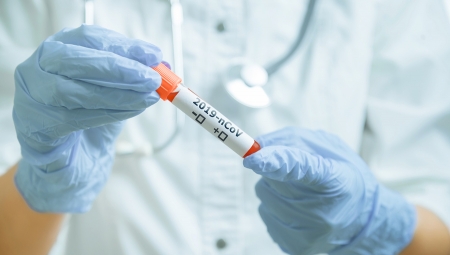 Γιατρός ή νοσοκόμος με προστατευτικά ιατρικά γάντια που κρατά δοκιμαστικό σωλήνα με αίμα για ανάλυση 2019-nCoV