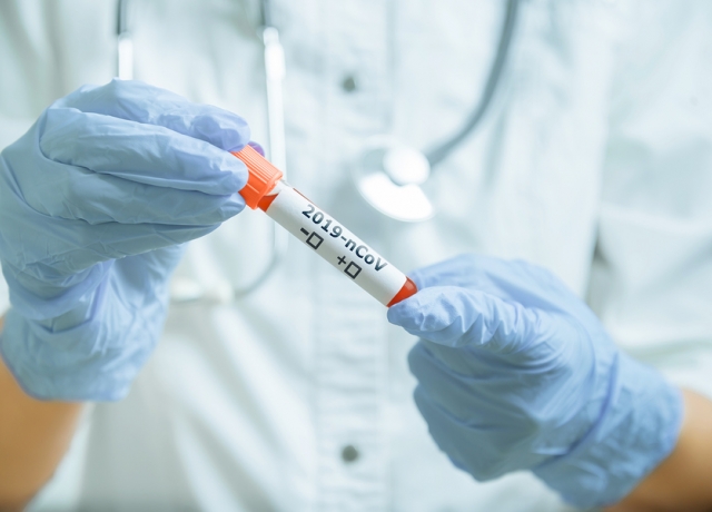 Γιατρός ή νοσοκόμος με προστατευτικά ιατρικά γάντια που κρατά δοκιμαστικό σωλήνα με αίμα για ανάλυση 2019-nCoV