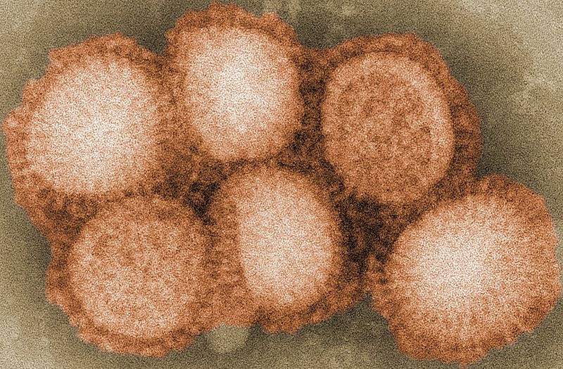 Εποχική Γρίπη 2010-2011